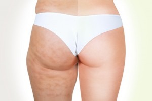 Meno cellulite per tutti!